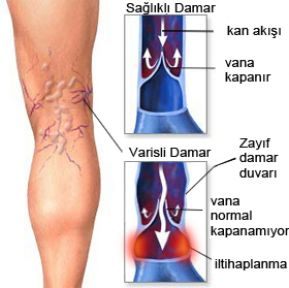 YAZ GEÇERKEN VARİSLERİNİZ KALICI OLMASIN